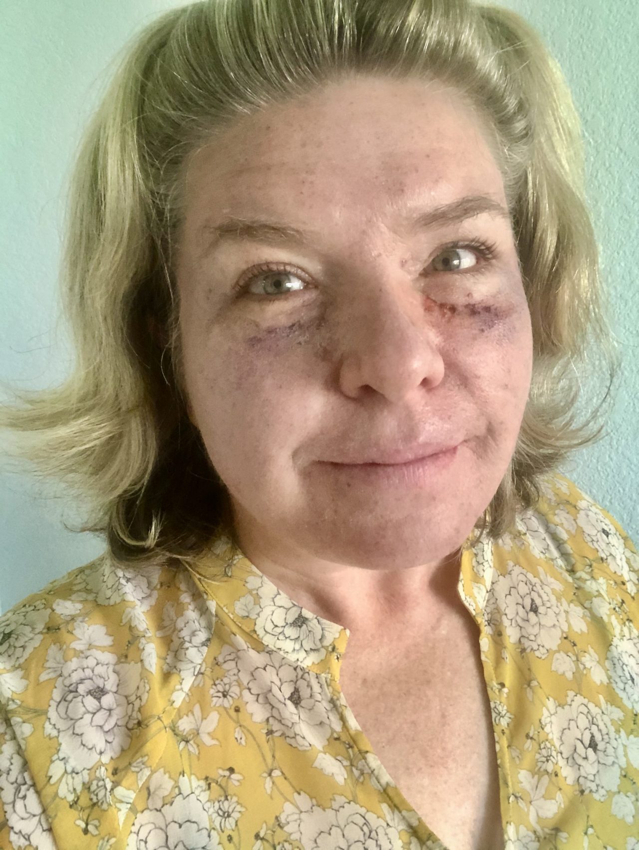 From Then To Now: Tara Mcconnell'S Journey After Her First Marriage - rrzur6f